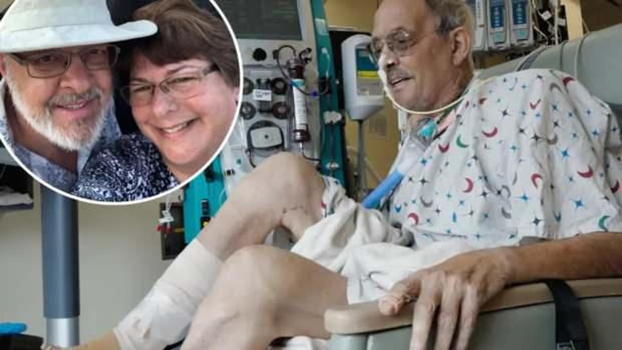 Domuz kalbi nakledilen ikinci hasta da hayatını kaybetti