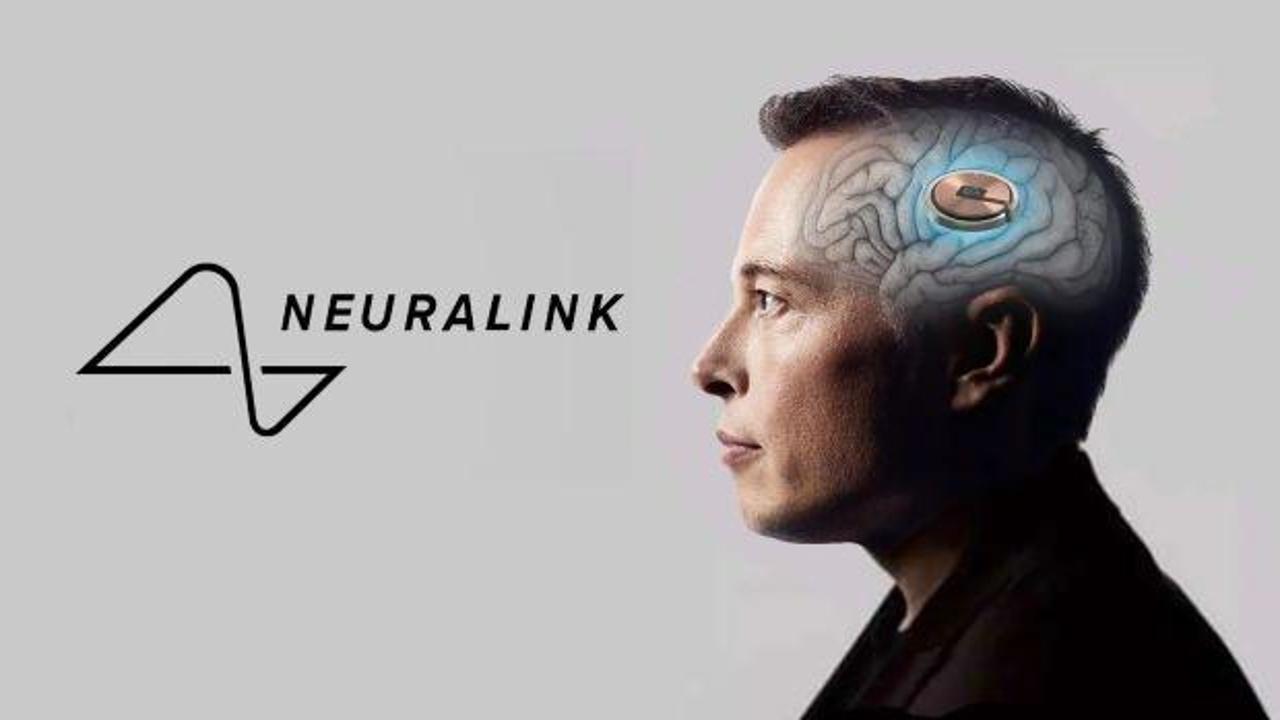 Binlerce kişi kafasına çip taktırmak için başvurdu!