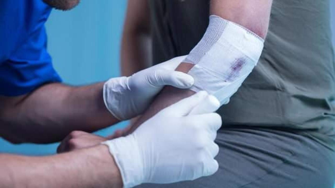 İç kanama nedir, belirtileri nelerdir ve neden olur? İç kanamalarda ilk yardım nasıl yapılır?