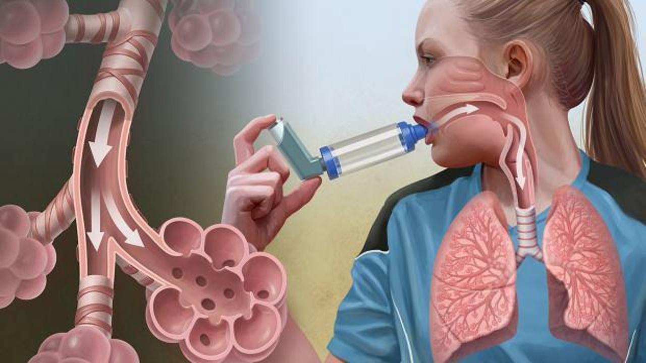 Klima ile bulaşan lejyoner hastalığı nedir, belirtileri nelerdir? Lejyoner hastalığı bulaşıcı mıdır?