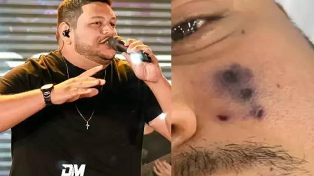 Örümceğin ısırdığı ünlü şarkıcı öldü