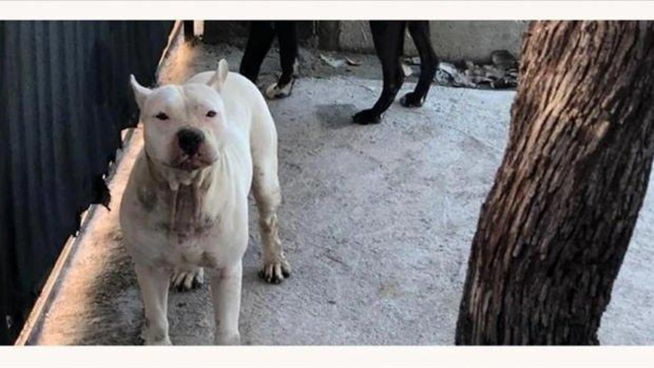 Adana’da pitbull cinsi köpeğin saldırısına uğrayan kız çocuğu yaralandı