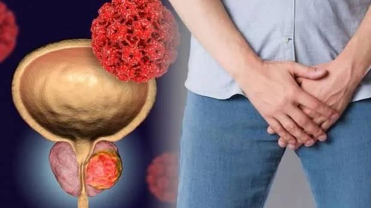 Prostat Hastalığında bir devrim! HoLEP ameliyatı nasıl yapılır?