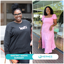 Gugu Gumede’nin Hermes Clinics’teki Kilo Verme Başarısı