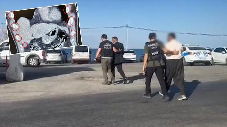 Midesinden çıkanlar şaşkına çevirdi